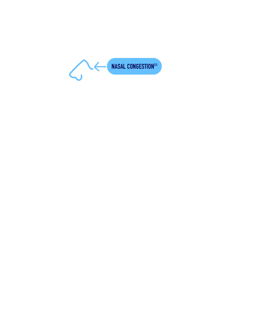 Illustration of respiratory track showing points where RSV infection symptoms could occur.