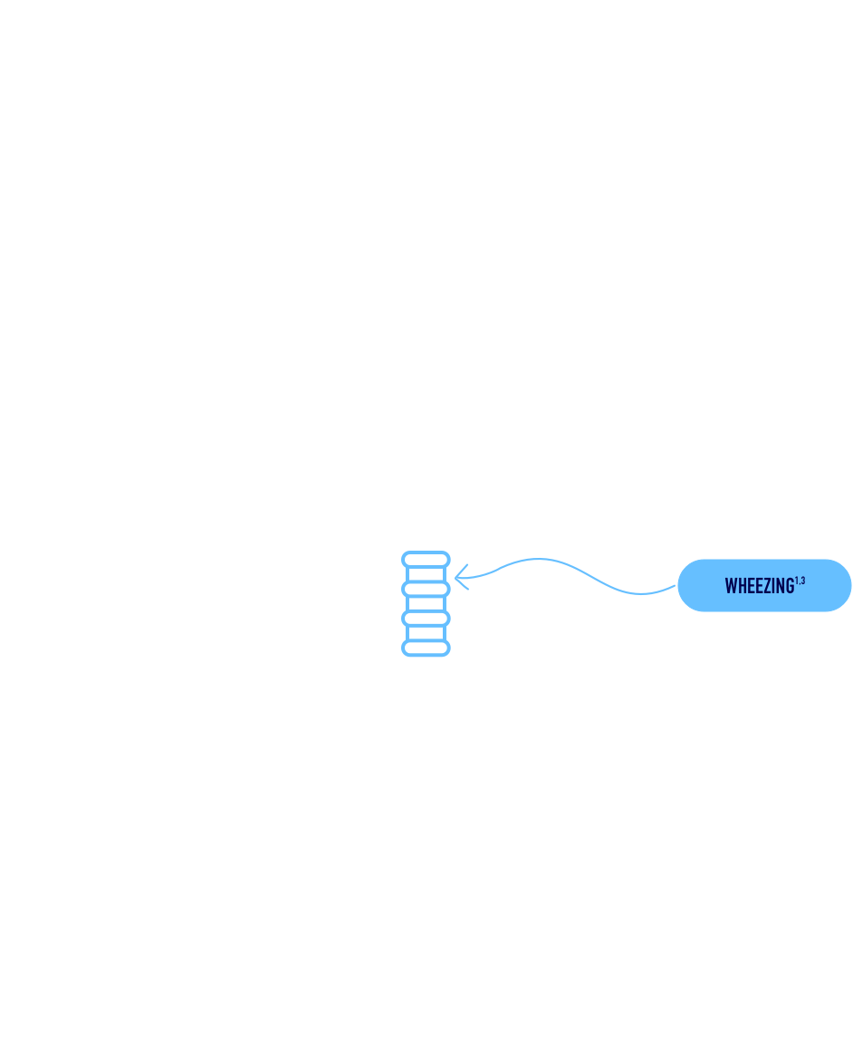 Illustration of respiratory track showing points where RSV infection symptoms could occur.